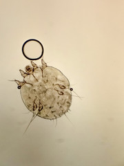 itch-mite, parasitic microorganism of human skin