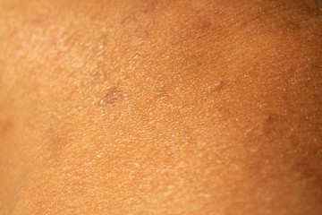 Fototapeta premium Woman's scar skin on leg, Close up & Macro shot, Asian Body skin part, Healthcare concept, Abstract background