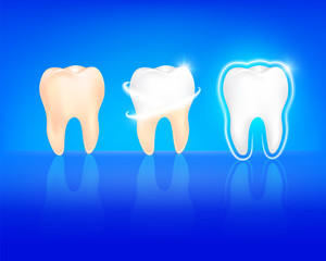 step of whitening tooth. Teeth Whitening. Dental care Concept. Illustration isolated on blue background.