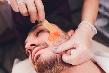 Hair removal. Man's face sugaring epilations beard trimming, yellow color, in cosmetology on the...