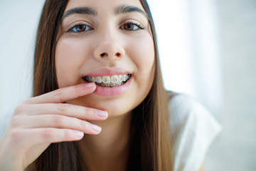 Girl in braces 