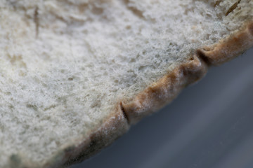 Rhizopus (bread mold) is a genus of common saprophytic fungi,Rhizopus (bread mold) under the microscope.