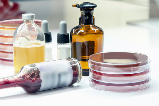 Hemoculture bottle positive; prepare subculture on selective media, Microbiology test in Laboratory