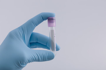 Doctor's hand with medical glove holds an empty tube for a blood probe