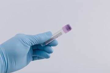Doctor's hand with medical glove holds an empty tube for a blood probe