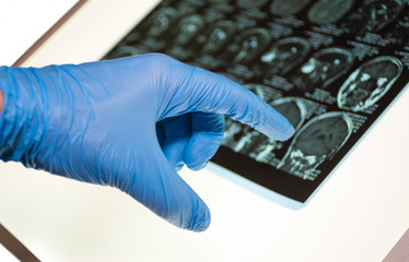 Doctor pointing on x-ray image of brain