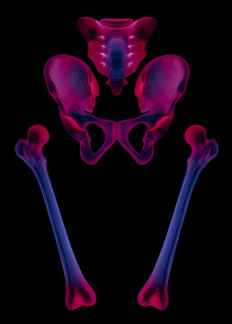 X-ray of separate human hip and femur bone anterior view red highlight in pain area- 3D Medical and Biomedical illustration-Healthcare- Human Anatomy and Medical Concept- Blue tone color