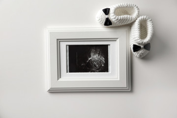 Ultrasound photo of baby and knitted boots on white background, top view