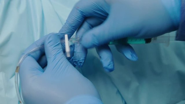 Gloved medical hands use syringe to insert blue liquid into tube or IV