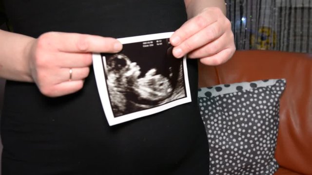 female hands holding photo ultrasound on the background of a pregnant belly