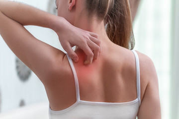 Young woman suffering from itching on her skin and scratching an itchy place. Allergic reaction to...