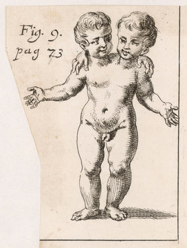 Two Headed Child 1691