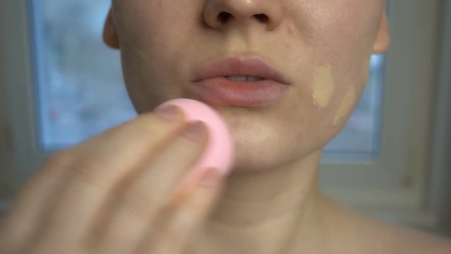 Close up of skin problems (unhealthy skin with acne and pimples). Masking of problem skin.