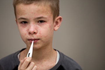 Portrait of sick sad boy child with thermometer having fever suffering from measles or chicken pox with bumps all over face. Contagious child diseases and treatment.
