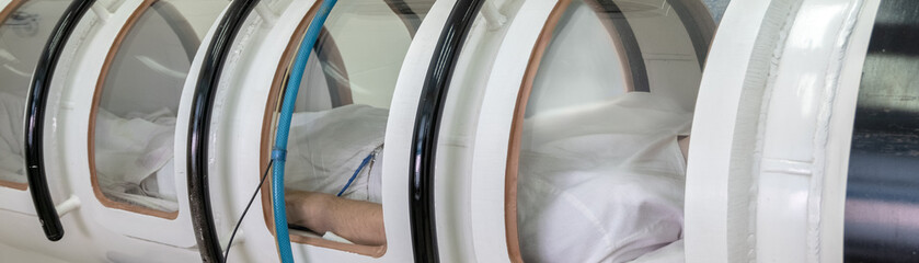 A hyperbaric chamber with a man lying inside. Treatment in an oxygen capsule. A pressure chamber...