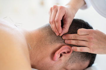 close up of mans ear acupuncture needle 