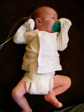 Infant With Oxygen Tubes