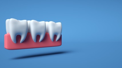 Teeth In Gums Isolated On The Blue Background. Dental And Medicine Concept - 3D Illustration