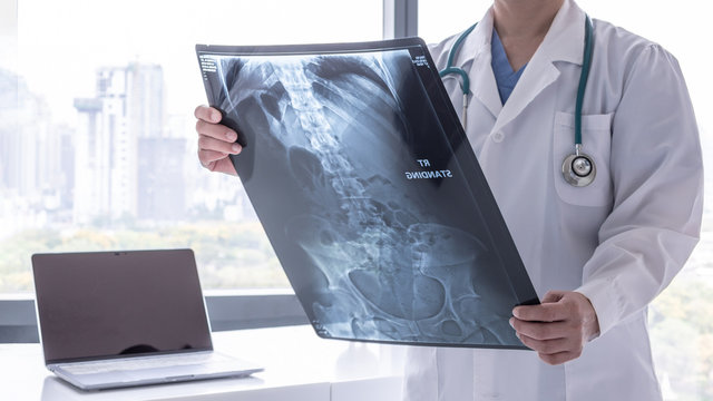 Stomach x-ray film image with doctor for medical and radiological diagnosis on female patient’s health on abdominal disease and bone cancer illness, healthcare hospital service concept