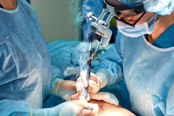 Team of surgeons makes an invasive operation. Portrait of surgeons close-up. Work with a...