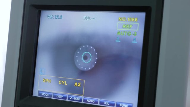 Equipment of modern ophthalmology device in clinic. Keratometer - modern automated machine examining eyeball.