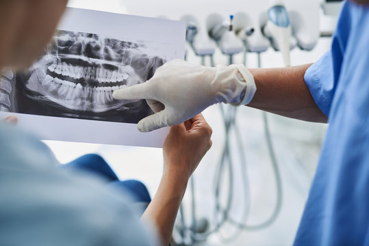 Young lady holding dental x-ray while dentist pointing at it