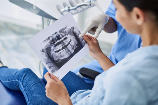 Young lady looking at dental x-ray while dentist pointing at it
