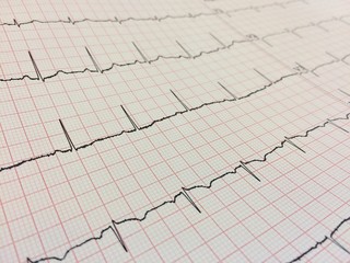 Close up of Electrocardiogram, Electrocardiography or EKG chart using for fetal heart monitoring....