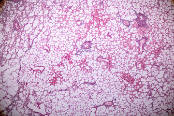 Concept of Education anatomy and Human lung tissue under microscope, The lungs is organs of the...