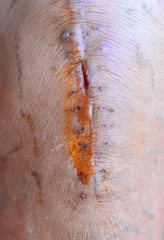 Image of postoperative wound on the knee area
