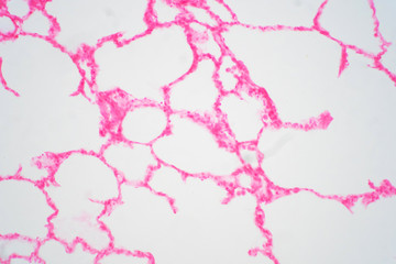 Human lung tissue under microscope view.