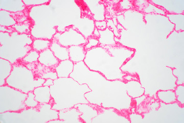 Human lung tissue under microscope view.
