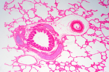 Human lung tissue under microscope view.