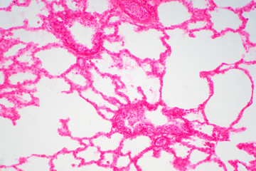 Human lung tissue under microscope view.