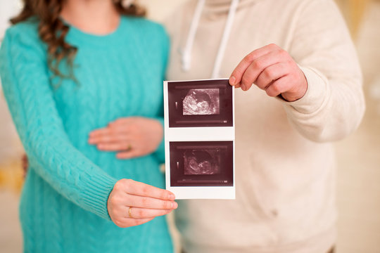 Asian couple with ultrasound photo in her hand,Thailand pregnant woman on white background