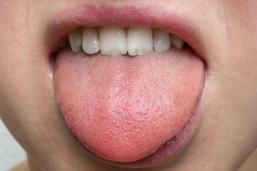 Woman with open mouth showing tongue
