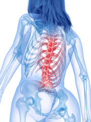 3d rendered medically accurate illustration of a painful back