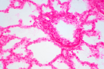 Human lung tissue under microscope view.