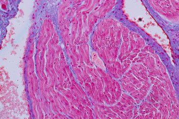 Education anatomy and Histological sample Heart muscle Tissue under the microscope.