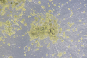 Close up of Aspergillus oryzae is a filamentous fungus, or mold that is used in food production, such as in soybean fermentation for education in laboratory.(soft focus and have Grain/Noise)