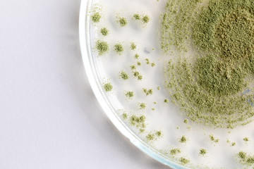 Close up of Aspergillus oryzae is a filamentous fungus, or mold that is used in food production, such as in soybean fermentation for education in laboratory.(soft focus and have Grain/Noise)