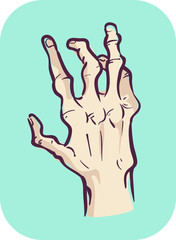 Hands Symptom Joint Deformity Illustration