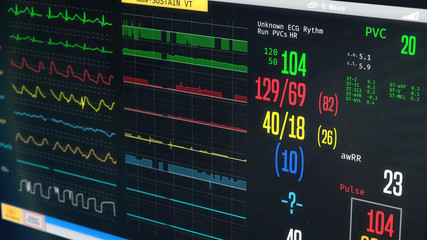 ICU medical monitor, patient's condition getting worse, irregular heartbeat.