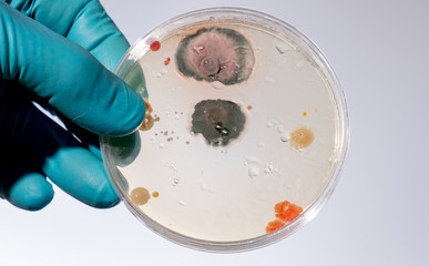 petri dish with microbe colony in doctor hand