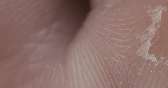 The texture of the skin. Human skin. Macro photo. Close up.