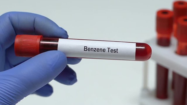 Benzene Test, doctor holding blood sample in tube close-up, health check-up