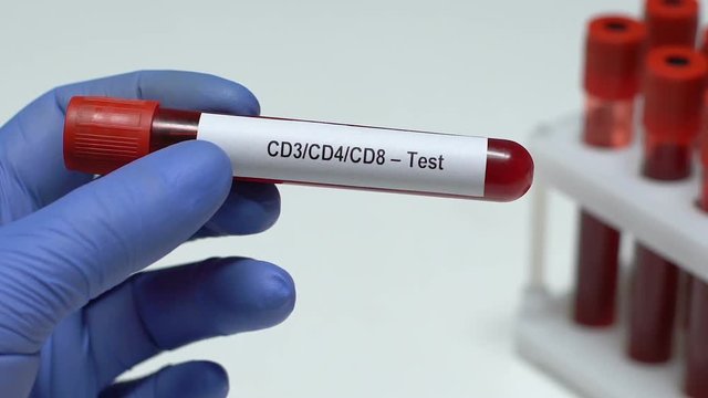 CD3 CD4 CD8-Test, doctor holding blood sample in tube close-up, health check-up