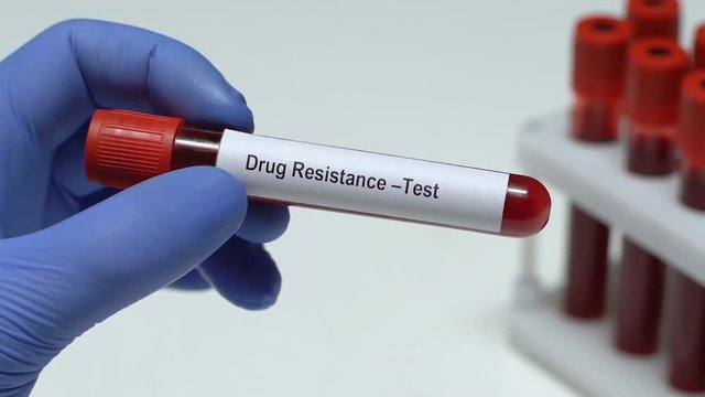 Drug Resistance-Test, doctor holding blood sample in tube close-up, health