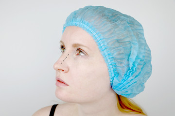 Rhinoplasty: patient on admission to a plastic surgeon. She has to go through the nose
