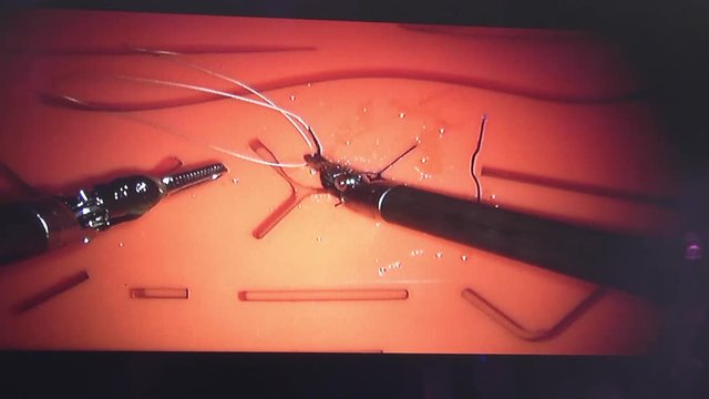 Medical robot da Vinci. Robotic Surgery. The surgeon is trained to perform operations on a medical robot. Minimally Invasive Robotic Surgery with the da Vinci Surgical System.